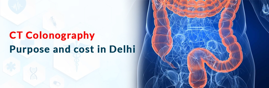 CT Colonography: Purpose and cost in Delhi